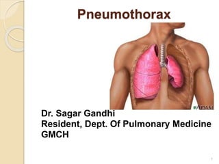 Pneumothorax
Dr. Sagar Gandhi
Resident, Dept. Of Pulmonary Medicine
GMCH
1
 