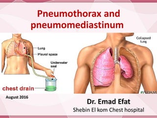 Pneumothorax and
pneumomediastinum
Dr. Emad Efat
Shebin El kom Chest hospital
June 2017
 