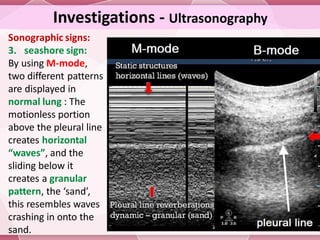 Pneumothorax and Pneumomediastinum...... | PDF