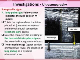 Pneumothorax and Pneumomediastinum...... | PDF