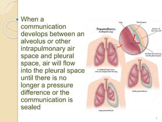  When a
communication
develops between an
alveolus or other
intrapulmonary air
space and pleural
space, air will flow
into the pleural space
until there is no
longer a pressure
difference or the
communication is
sealed
5
 