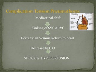 Mediastinal shift
Kinking of SVC & IVC
Decrease in Venous Return to heart
Decrease In C.O
SHOCK & HYPOPERFUSION
 