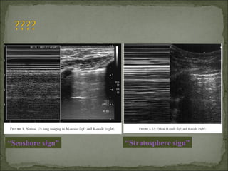 “Seashore sign” “Stratosphere sign”
 