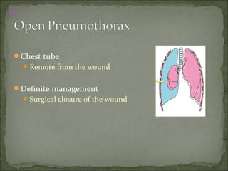 Chest tube
Remote from the wound
Definite management
Surgical closure of the wound
Rx
 