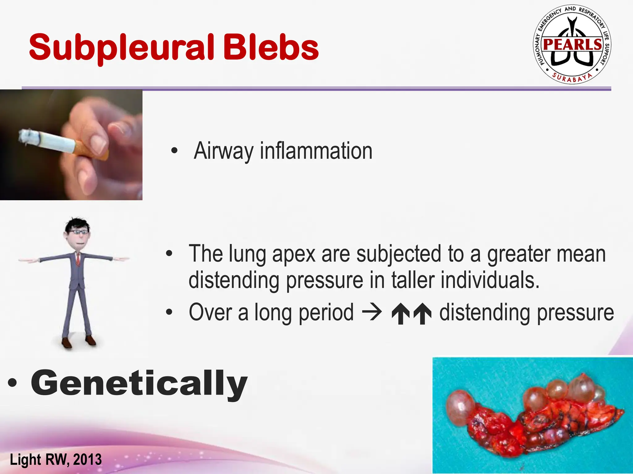 Small Bleb Pneumothorax PEARLS catatan kecil dokter | PDF