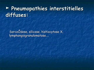 ► Pneumopathies interstitielles
diffuses:


 Sarcoïdose, silicose, histiocytose X,
 lymphangiogranulomatose….
 
