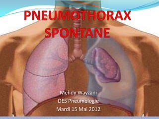 Mehdy Wayzani
DES Pneumologie
Mardi 15 Mai 2012
 