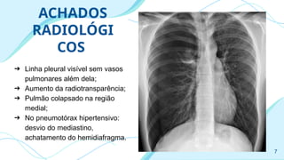 ACHADOS
RADIOLÓGI
COS
➔ Linha pleural visível sem vasos
pulmonares além dela;
➔ Aumento da radiotransparência;
➔ Pulmão colapsado na região
medial;
➔ No pneumotórax hipertensivo:
desvio do mediastino,
achatamento do hemidiafragma.
7
 