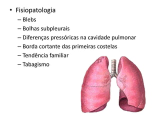 • Fisiopatologia
– Blebs
– Bolhas subpleurais
– Diferenças pressóricas na cavidade pulmonar
– Borda cortante das primeiras costelas
– Tendência familiar
– Tabagismo
 