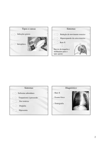 2
Tipos e causas
Infecções graves
Iatrogênico
Sintomas
Redução do movimento toracico
Hiperexpansão da caixa toracica
Raio X
Desvio da traquéia e
mediastino para o
lado oposto
Sintomas
Enfisema subcutâneo
Timpanismo á percussão
Dor torácica
Dispnéia
Hipoxemia
Diagnóstico
- Raio X
- Exame físico
- Tomografia
 