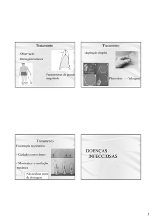 3
Tratamento
Pneumotórax de grande
magnitude
- Observação
- Drenagem torácica
Tratamento
- Aspiração simples
- Pleurodese “talcagem”
Tratamento
Fisioterapia respiratória
- Cuidados com o dreno
- Monitorizar a ventilação
mecânica
Não realizar antes
da drenagem
DOENÇAS
INFECCIOSAS
 