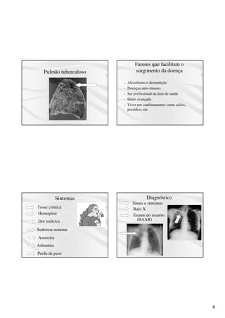 6
Pulmão tuberculoso
Fatores que facilitam o
surgimento da doença
- Alcoolismo e desnutrição
- Doenças auto-imunes
- Ser profissional da área de saúde
- Idade avançada
- Viver em confinamentos como asilos,
presídios, etc
Sintomas
Tosse crônica
Hemoptise
Dor torácica
Sudorese noturna
Anorexia
Adinamia
Perda de peso
Diagnóstico
Sinais e sintomas
Raio X
Exame do escarro
(BAAR)
 