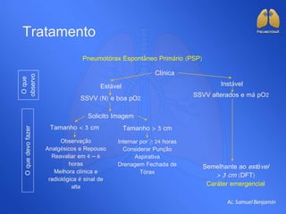 Tratamento
Pneumotórax Espontâneo Primário (PSP)
Clínica
Estável Instável
Semelhante ao estável
> 3 cm (DFT)
Caráter emergencial
Oque
observo
Oquedevofazer
SSVV (N) e boa pO2 SSVV alterados e má pO2
Solicito Imagem
Tamanho < 3 cm Tamanho > 3 cm
Observação
Analgésicos e Repouso
Reavaliar em 4 – 6
horas
Melhora clínica e
radiológica é sinal de
alta
Internar por ≥ 24 horas
Considerar Punção
Aspirativa
Drenagem Fechada de
Tórax
 