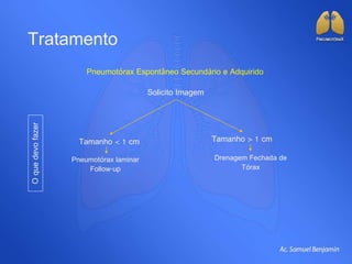Tratamento
Pneumotórax Espontâneo Secundário e Adquirido
Oquedevofazer
Solicito Imagem
Tamanho < 1 cm Tamanho > 1 cm
Pneumotórax laminar
Follow-up
Drenagem Fechada de
Tórax
 