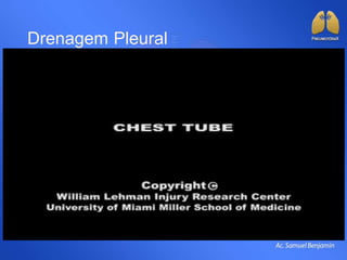 Drenagem Pleural
 