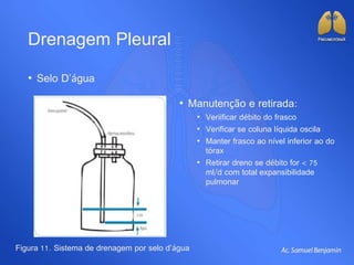 Drenagem Pleural
• Selo D’água
Figura 11. Sistema de drenagem por selo d’água
• Manutenção e retirada:
• Veriificar débito do frasco
• Verificar se coluna líquida oscila
• Manter frasco ao nível inferior ao do
tórax
• Retirar dreno se débito for < 75
ml/d com total expansibilidade
pulmonar
 