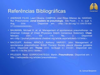 Referências Bibliográficas
• ANDRADE FILHO, Laert Oliveira; CAMPOS, José Ribas Milanez de; HADDAD,
Rui. Pneumotórax. Jornal brasileiro de pneumologia, São Paulo , v. 32, supl. 4,
Aug. 2006 . Disponível em: <http://dx.doi.org/10.1590/S1806-
37132006000900008>.
• BAUMANN, Michael H. et. al. Management of spontaneous pneumothorax: na
American Coleege pf Chest Physicians Delphi Consensus Statement. Chest,
february 2001, Vol 119, No. 2. Disponível
em:<http://journal.publications.chestnet.org/article.aspx?articleid=1079496>.
• MACDUFF, Andrew; ARNOLD, Anthony; HARVEY, John. Management of
spontaneous pneumothorax: British Thoracic Society pleural disease guideline
2010. Disponível em: Thorax 2010; 56(Suppl 2): ii18-ii31. Disponível em:
<doi:10.1136/thx.2010.136986>.
• PFLEGER, René. GORROCHATEGUI, Martin. Pneumothorax. Disponível em: <
http://radiopaedia.org/articles/pneumothorax>.
 