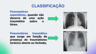 CLASSIFICAÇÃO
Pneumotórax
espontâneo, quando não
decorre de uma ação
traumática sobre o
tórax.
Pneumotórax traumático
que surge em função da
presença de traumatismo
torácico aberto ou fechado,
 