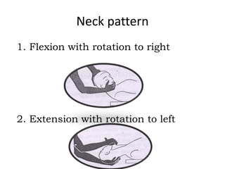 Neck pattern
1. Flexion with rotation to right
2. Extension with rotation to left
 