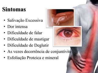 Sintomas
•   Salivação Excessiva
•   Dor intensa
•   Dificuldade de falar
•   Dificuldade de mastigar
•   Dificuldade de Deglutir
•   As vezes decorrência de conjuntivite
•   Esfoliação Proteica e mineral
 
