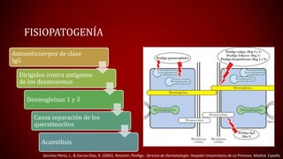 FISIOPATOGENÍA 
Autoanticuerpos de clase 
IgG 
Dirigidos contra antígenos 
de los desmosomas 
Desmogleínas 1 y 3 
Causa separación de los 
queratinocitos 
Acantólisis 
Sánchez-Pérez, J., & García-Díez, A. (2005). Revisión: Pénfigo . Servicio de Dermatología. Hospital Universitario de La Princesa. Madrid. España. 
 