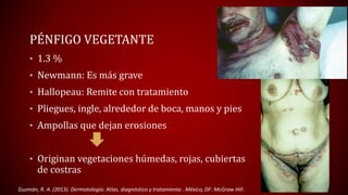PÉNFIGO VEGETANTE 
• 1.3 % 
• Newmann: Es más grave 
• Hallopeau: Remite con tratamiento 
• Pliegues, ingle, alrededor de boca, manos y pies 
• Ampollas que dejan erosiones 
• Originan vegetaciones húmedas, rojas, cubiertas 
de costras 
Guzmán, R. A. (2013). Dermatología: Atlas, diagnóstico y tratamiento . México, DF: McGraw Hill . 
 