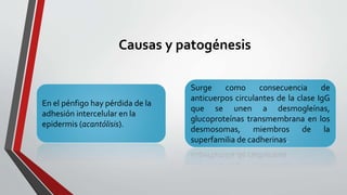Causas y patogénesis
En el pénfigo hay pérdida de la
adhesión intercelular en la
epidermis (acantólisis).
Surge como conse...