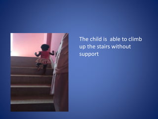 The child is able to climb
up the stairs without
support
 