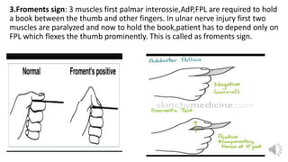 pni assessment peripheral injuries managment | PDF