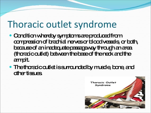 ulnar Entrapment Neuropathy and double crush syndrome - Double Crush Syndrome Signs And Symptoms