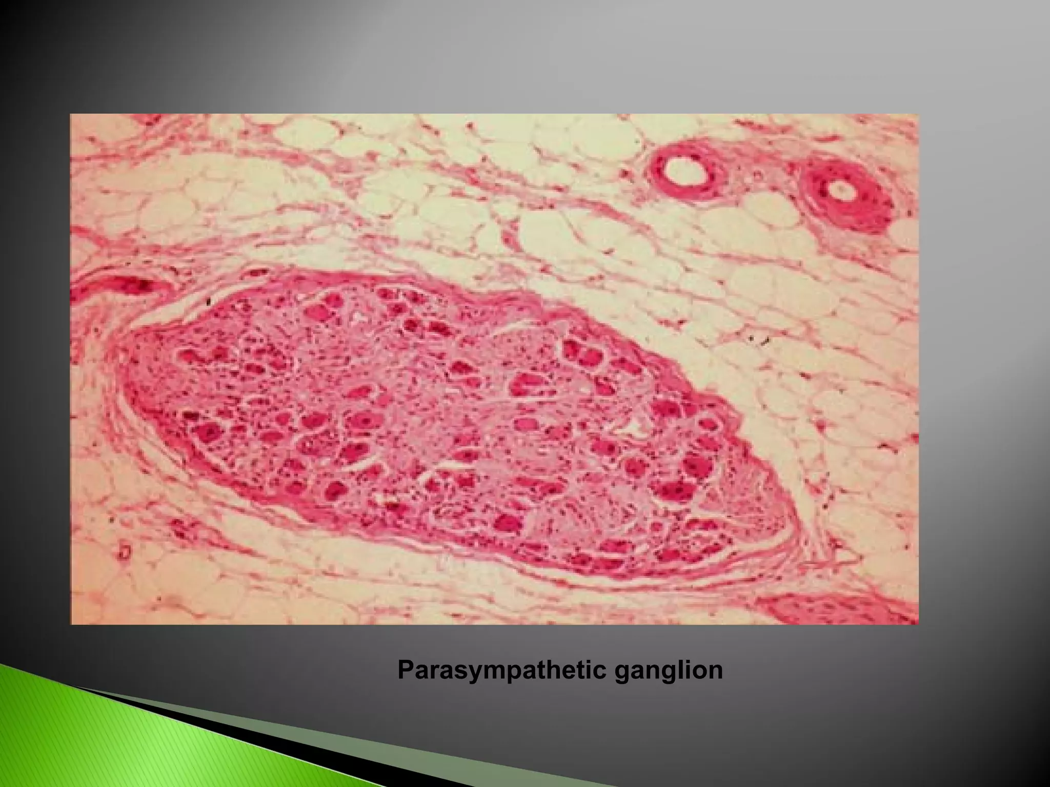 Parasympathetic ganglion 