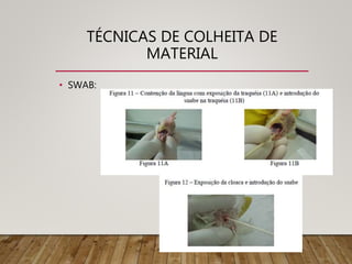 TÉCNICAS DE COLHEITA DE
MATERIAL
• SWAB:
 