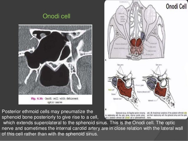 PNS (Para-nasal-sinuses) anatomy and variants
