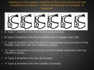 Variations in the superior insertion of the uncinate process are
classified according to criteria developed by Landsber &
Friedman

 A: Type 1 (insertion into the lamina papyracea).

 B: Type 2 (insertion into the posterior wall of agger nasi cell).
 C: Type 3 (insertion into the lamina papyracea and junction of the

middle turbinate with the cribriform plate).

 D: Type 4 (insertion in to junction of the middle turbinate with the

cribriform plate).

 E: Type 5 (insertion into the skull base).
 F: Type 6 (insertion into the middle turbinate)

 