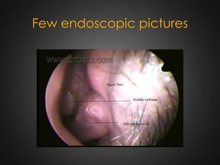 Few endoscopic pictures

 