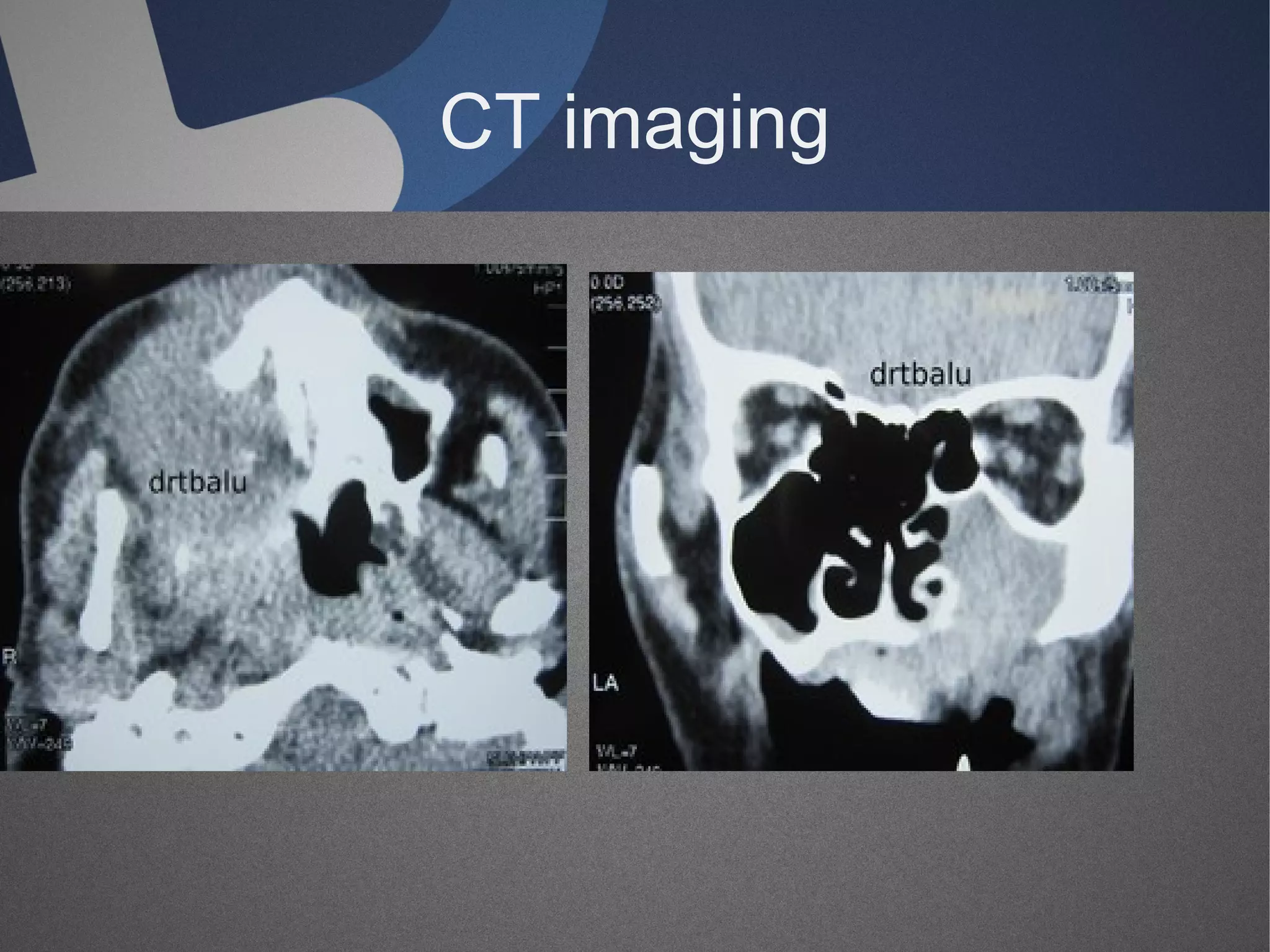 CT imaging

 