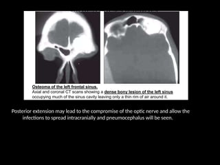 Posterior extension may lead to the compromise of the optic nerve and allow the
infections to spread intracranially and pneumocephalus will be seen.
 
