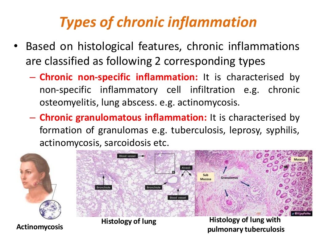 Pathophysiology inflammation and repair