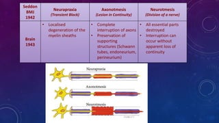 Seddon
BMJ
1942
Neurapraxia
(Transient Block)
Axonotmesis
(Lesion in Continuity)
Neurotmesis
(Division of a nerve)
Brain
1943
• Localised
degeneration of the
myelin sheaths
• Complete
interruption of axons
• Preservation of
supporting
structures (Schwann
tubes, endoneurium,
perineurium)
• All essential parts
destroyed
• Interruption can
occur without
apparent loss of
continuity
 