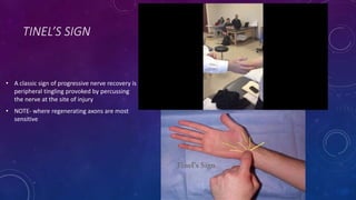 TINEL’S SIGN
• A classic sign of progressive nerve recovery is
peripheral tingling provoked by percussing
the nerve at the site of injury
• NOTE- where regenerating axons are most
sensitive
 