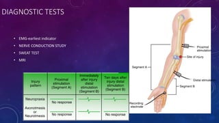 DIAGNOSTIC TESTS
• EMG-earliest indicator
• NERVE CONDUCTION STUDY
• SWEAT TEST
• MRI
 