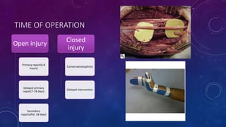 TIME OF OPERATION
Open injury
Primary repair(6-8
hours)
Delayed primary
repair(7-18 days)
Secondary
repair(after 18 days)
Closed
injury
Conservative(splints)
Delayed intervention
 