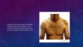 • A patient with a past history of shoulder
dislocation,which was reduced in phc
and c/o weakness in abduction and loss
of sensory supply of lateral aspect of arm
 