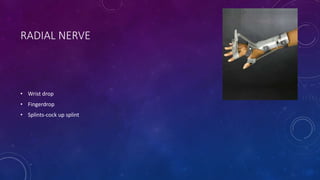 RADIAL NERVE
• Wrist drop
• Fingerdrop
• Splints-cock up splint
 