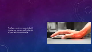 • A software engineer presented with
tingling and numbness of radial side
of hand with thenar atrophy
 