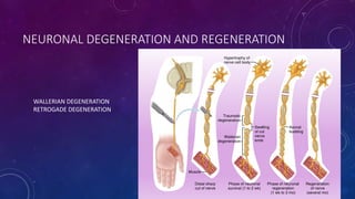 NEURONAL DEGENERATION AND REGENERATION
WALLERIAN DEGENERATION
RETROGADE DEGENERATION
 