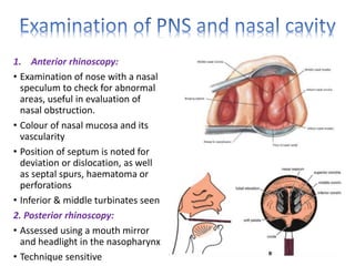 Anterior rhinoscopy findings; A. Patent right nasal cavity; B