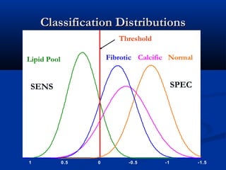 Classification DistributionsClassification Distributions
-1.5-1-0.500.51
Lipid Pool CalcificFibrotic Normal
Threshold
SENS SPEC
 