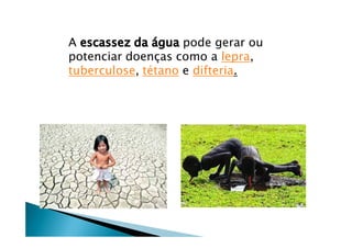 A escassez da Ögua pode gerar ou
potenciar doenÅas como a lepra,
tuberculose, tÑtano e difteria.
 