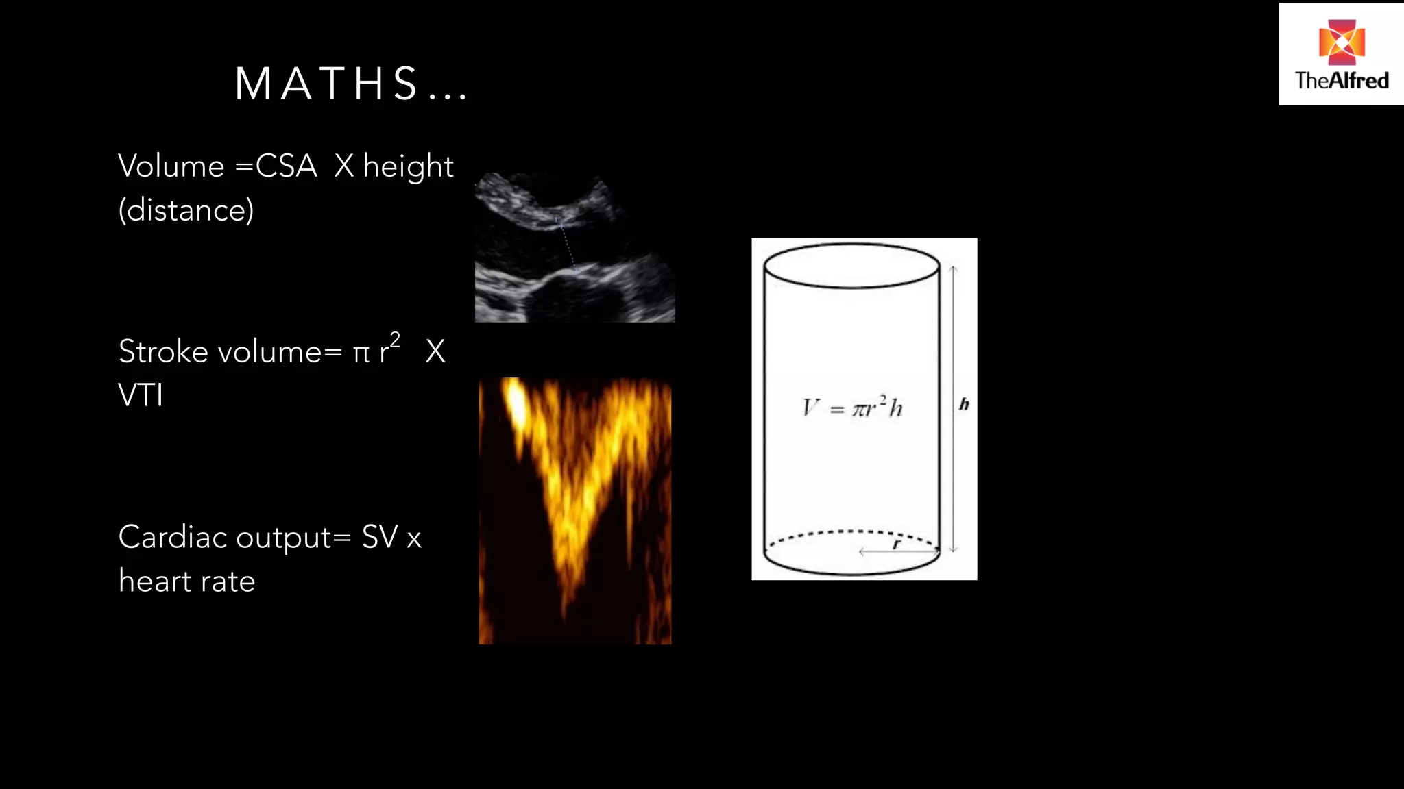 MATHS… 
Volume =CSA X height 
(distance) 
! 
Stroke volume= π r2 X 
VTI 
! 
Cardiac output= SV x 
heart rate 
 